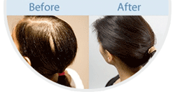 before-and-after'
