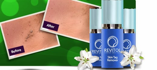 Revitol Skin Tag Remover'