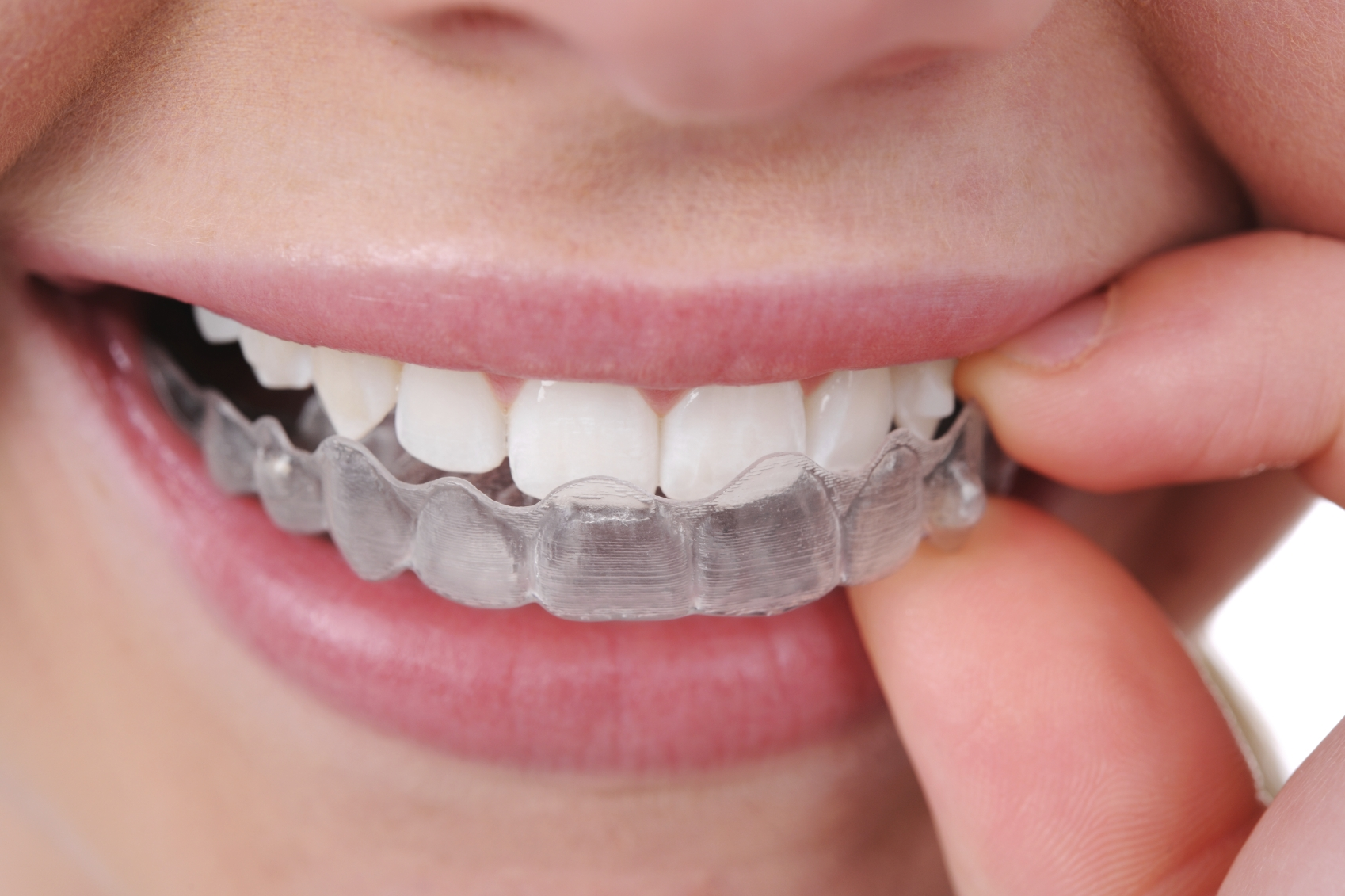 Orchard Orthodontics'