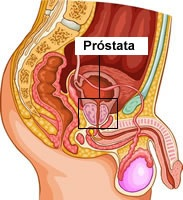 Prostate Health'