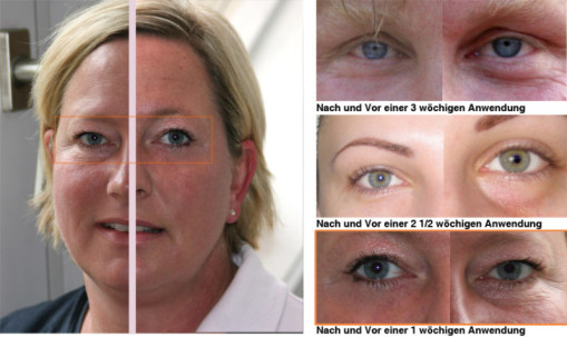 Facelift Gym Review'