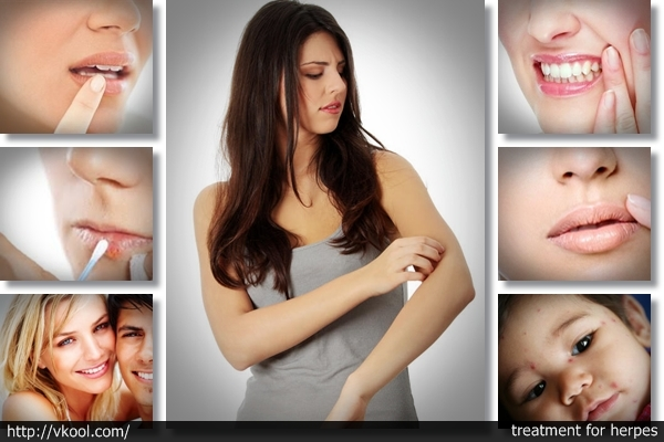 Get Rid of Herpes Program - Real Genital Herpes Treatment by'