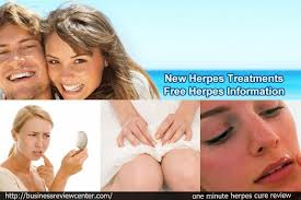 Get Rid of Herpes Naturally &amp;amp; Fast - PDF Book Downlo'