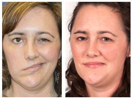 The Facial Paralysis Institute