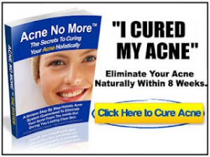 Acne No More'