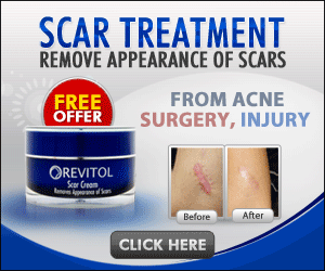 Revitol Scar Cream'