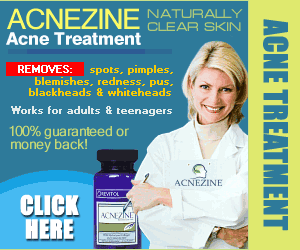 acnezine