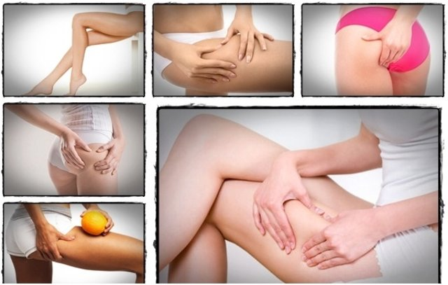 Truth About Cellulite by Joey Atlas'
