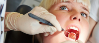 Xpress Dental Services