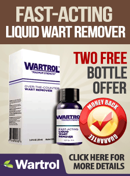 Wartrol Warts Removal'