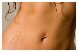 do stretch marks go away'