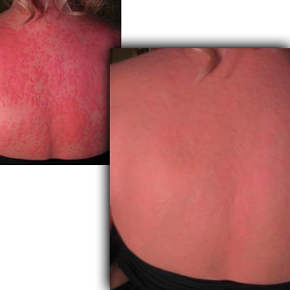 OxyHives Reviews'