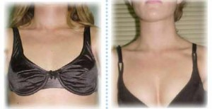 Breast Actives Breast Enhancment'