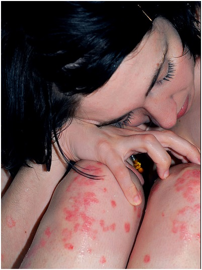 Skin-Cure.org'