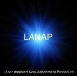 LANAP