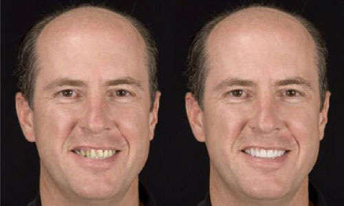 Improving First Impressions Study - AACD