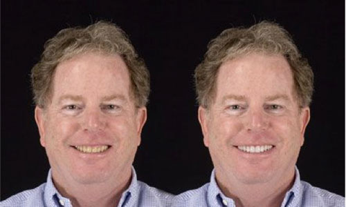 2-Improving First Impressions Study - AACD