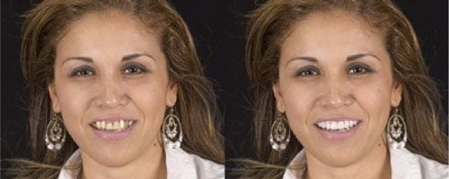 3-Improving First Impressions Study - AACD
