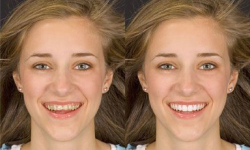 4-Improving First Impressions Study - AACD