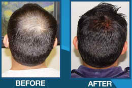 Provillus Product Review