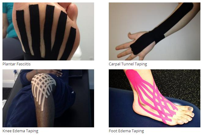 kinesiotaping'