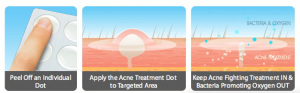 SkinHealix Acne Dots