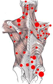 statins muscle pain