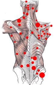 statins muscle pain'