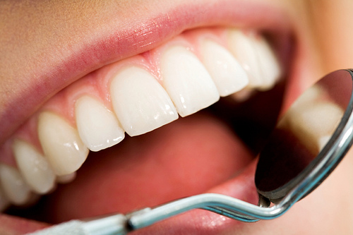Healthy Teeth'