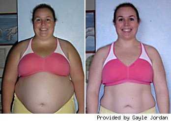 Before and After'