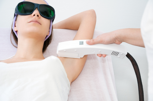 Laser Hair Removal'