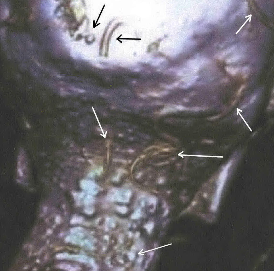 Dr. Joel Klenck: Mummy of Sitre-In.'
