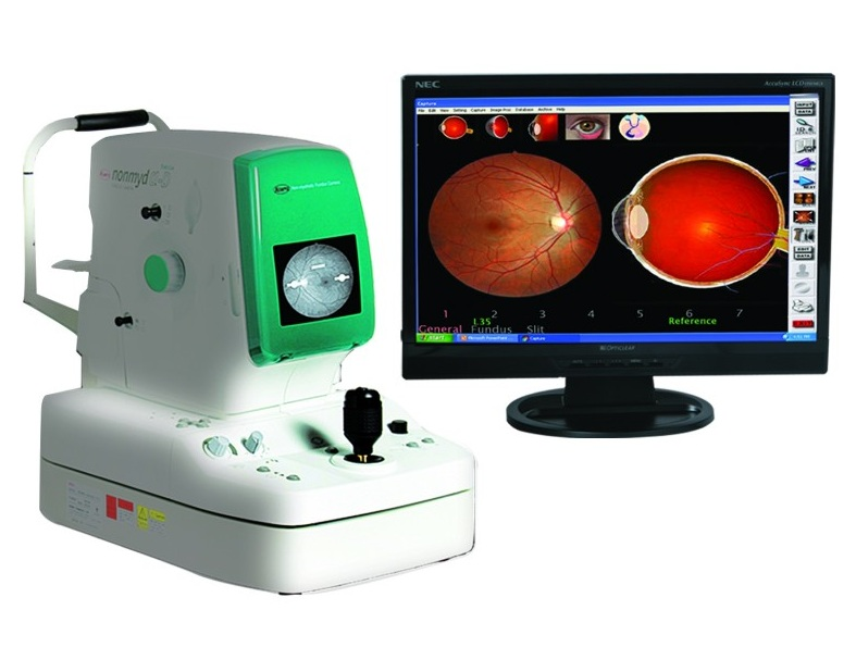 midwest eye associates Kowa Digital Fundus Camera composite'