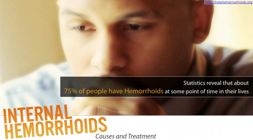 Hemorrhoids Home Treatment'