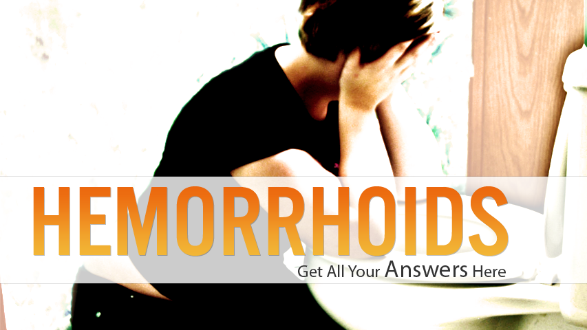 Cure External Hemorrhoids'
