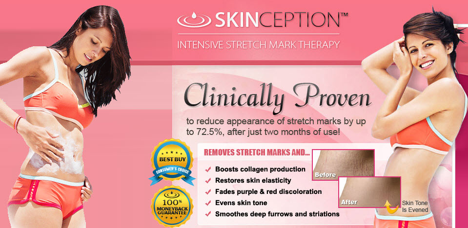 YourSTretchMarkCream.Com'