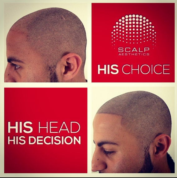 his head his choice