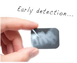 preventing mouth cancer