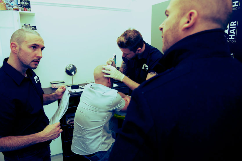 scalp micropigmentation