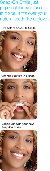 Snap-On Smile 2