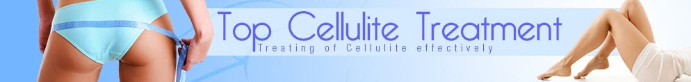 Top Cellulite Treatment'