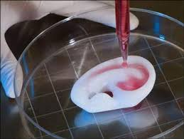 3D printing medical