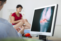 Osteoarthritis Clinical Research