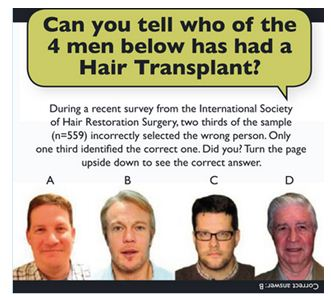 FUE Hair Transplant Clinics'
