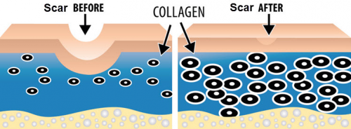 skin collagen'