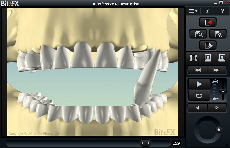 BiteFX software