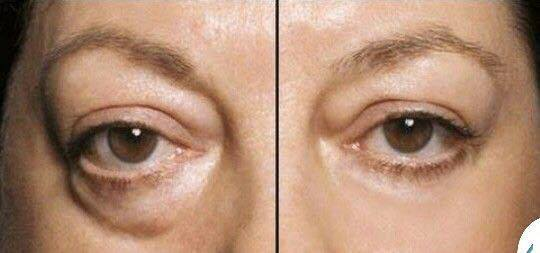 11140330_10153343989938968_1089676606321775974_n.jpg'