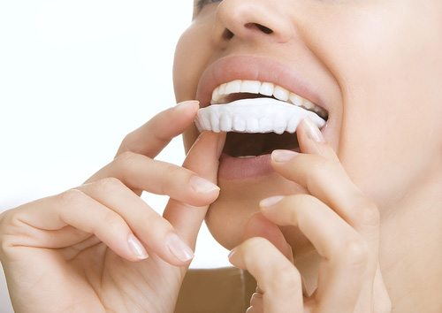 tooth whitening'