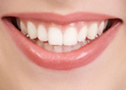 Orange County Dentist'