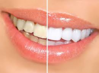 Kessler &amp; Resnick DDS - Aurora Cosmetic Dentist - Re
